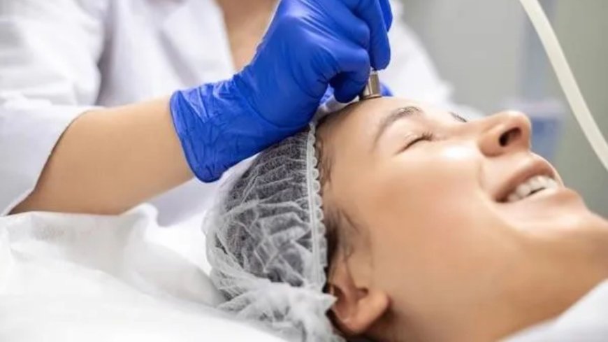 Why More Women in Indianapolis are Choosing Microneedling to Reset Their Skin—Naturally?