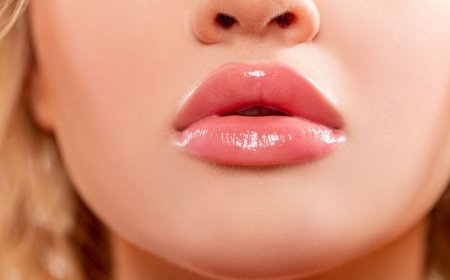 The Role of Hyaluronic Acid in Lip Augmentation: Benefits and Risks
