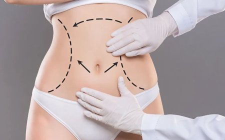 5 Common Myths About Body Jet Liposuction Debunked