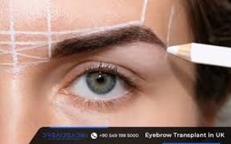 Is Getting an Eyebrow Transplant in London Better Than Travelling to Turkey?